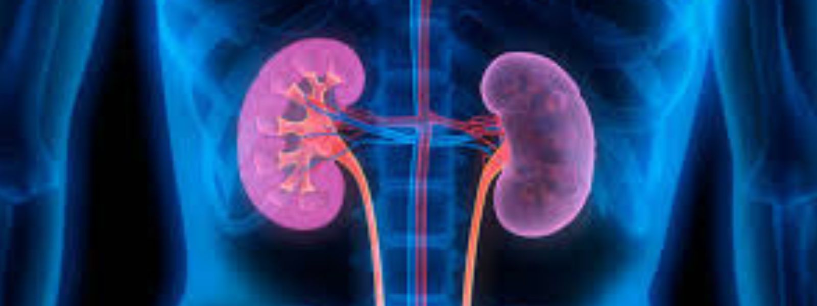 Five Sri Lankans Die Daily from Kidney Disease